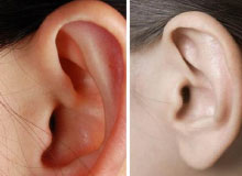 李忠教授教你从耳朵辨健康 远离癌症