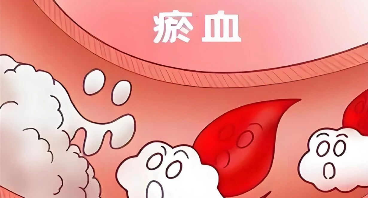 肿瘤患者贫血、有包块、疼痛，可能源于同一个问题！看看你的舌头上有没有这个信号